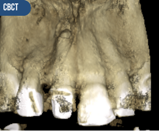 Vista CBCT de referencia, sin datos personales